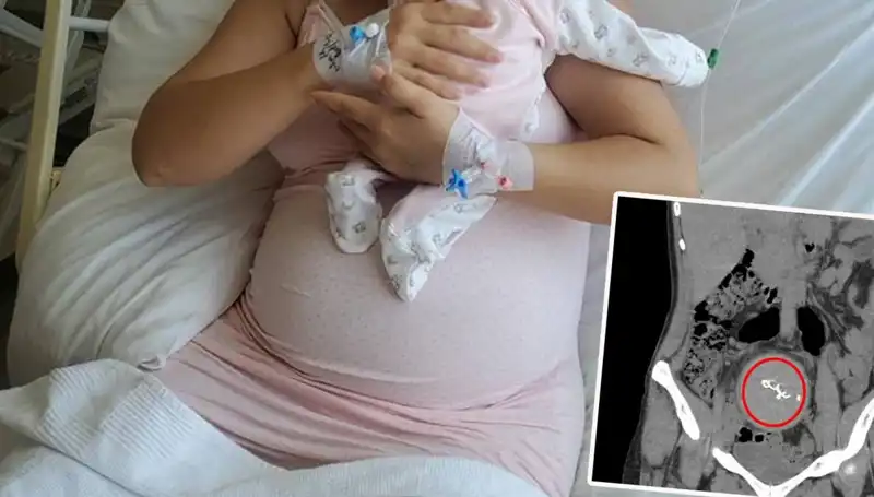 ** İki Yıl Sonra Ortaya Çıkan Şok İhmal: Doğumda Gazlı Bez Unutuldu